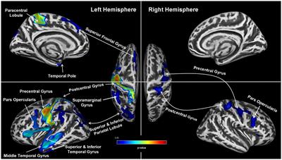 Cortical thinning in male obstructive sleep apnoea patients with excessive <mark class="highlighted">daytime sleepiness</mark>